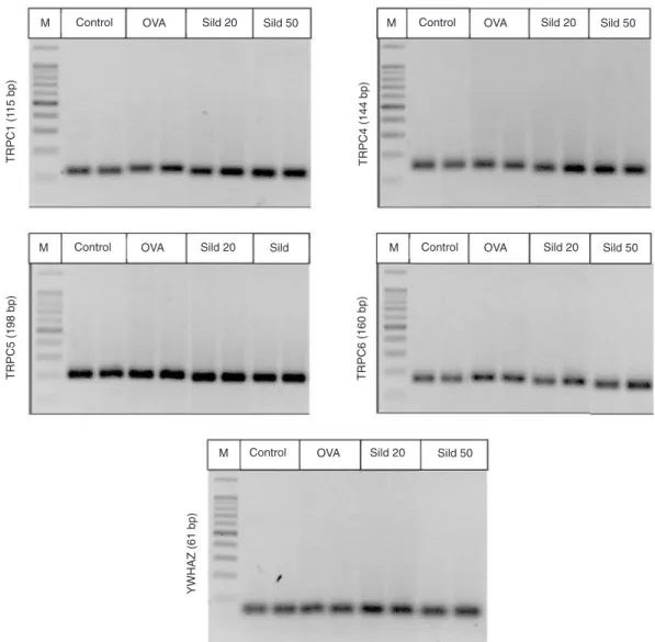 Figure  5. Agarose gel (2%) stained with ethidium bromide, showing the gene expression of TRPC1 (115 bp),  TRPC4 (144 bp), TRPC5 (198 bp), TRPC6 (160 bp), and YWHAZ (61 bp) in the rat trachea