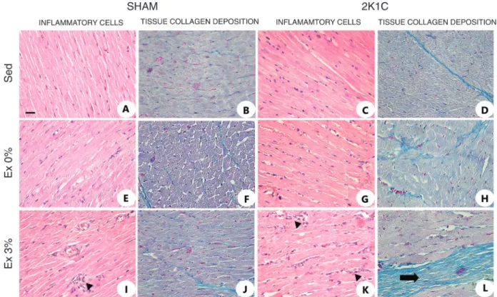 Figure 3. Photomicrographs of the heart ventricles of Sham and 2K1C sedentary (Sed) rats, and rats subjected to exercise training  (Ex) without (Ex 0%) or with a load corresponding to 3% of the animal’s body weight (Ex 3%)