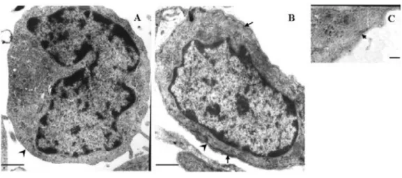 Figure 1.  Ultrastructure of normal skin and hypertrophic scar (HS) fibroblasts.  A , The normal fibroblast showed the  absence of myofibroblast-like features (arrowhead)