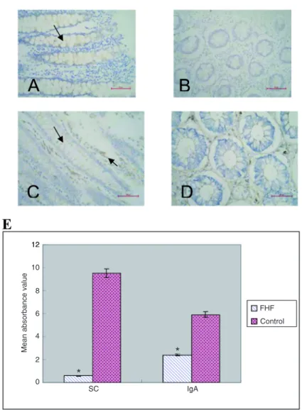 Figure 1.  Secretory component (SC) and IgA staining of intestinal epithelial cells  in patients with fulminant hepatic failure (FHF)