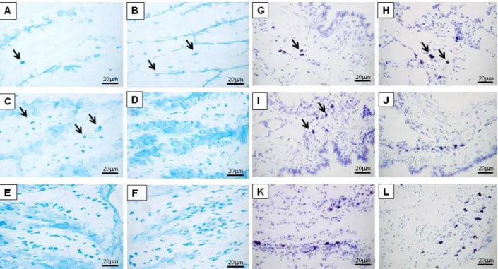 Figure 4. Light microscopy analysis of mast cell hyperplasia in the intestine or lung 1 (B, H), 3 (C, I), 6 (D, J), 18 (E, K), and 24 (F, L)  days after infection, respectively