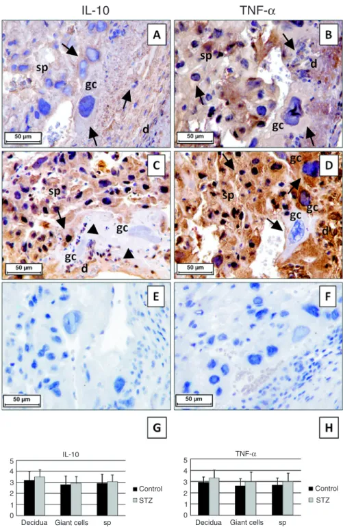 Figure  1.  Immunohistochemical  detection  of  interleukin-10  (IL-10;  A,C)  and  tumor  necrosis  factor-α (TNF-α; B,D) staining in late-gestation placentas (day 21) from control (A,B) and diabetic  (STZ; C,D) rats