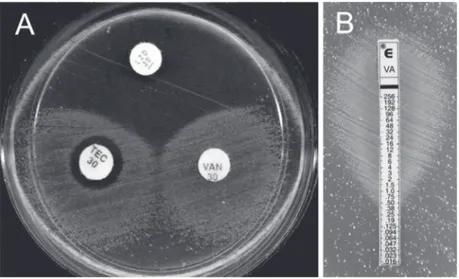 Figure 1. Growth dependence of  vanA Enterococcus faecium UEL (VDEfm-UEL). A,  Discs  impregnated  with  30  µg  linezolide  (LZD),  teicoplanin  (TEC),  and  vancomycin  (VAN) were placed on the surface of Muller Hinton agar plates previously inoculated  