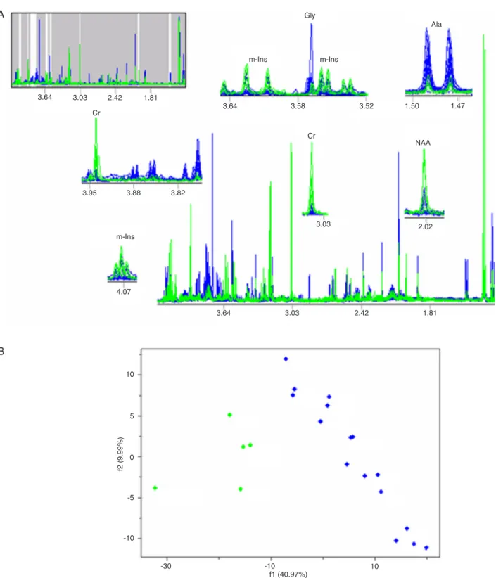 Figure 3. A,  1 H MRS spectral profiles: low-grade neuroglial tumors (green) and non-neuroglial tumors (blue)