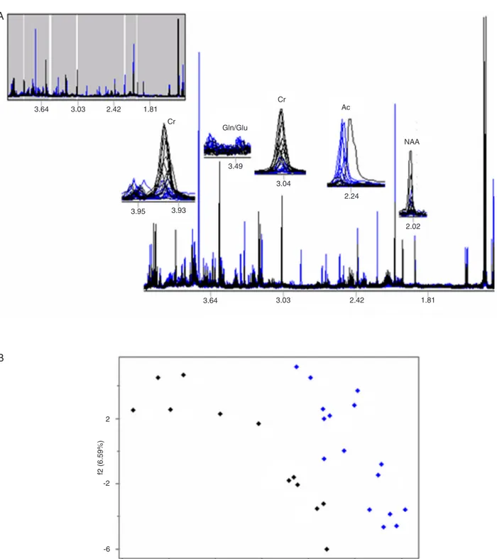 Figure 4. A,  1 H MRS spectral profiles: high-grade neuroglial tumors (black) and non-neuroglial tumors (blue)