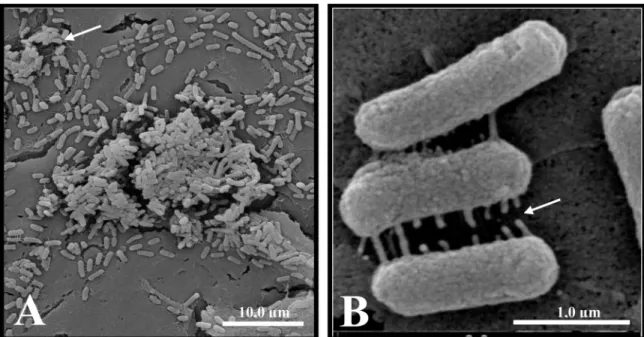 Figure 3. Scanning electron micrograph of human sepsis-associated Escherichia coli (SEPEC) 8 ( fim H + ,  flu + , csgA - ,  mat - ,  iha - , gimB - , ibeA - , tia - , neuC - ) adhesion after 3 h of incubation with Vero cells