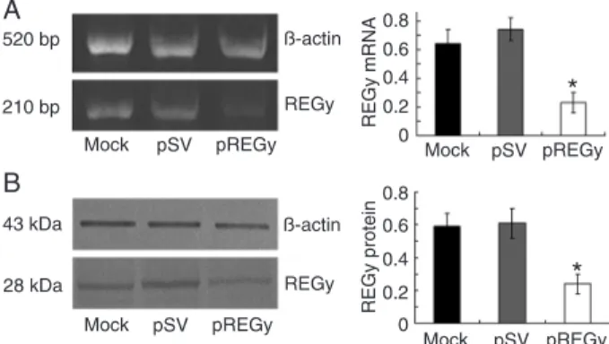Figure 1. Small interfering RNA knockdown of REGγ mRNA and  protein expression in SW579 cells