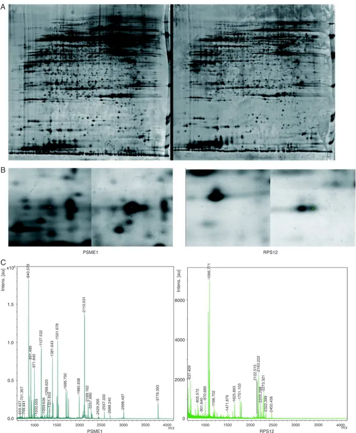 Figure 1. Detection and analysis of differentially expressed proteins in chronic atrophic gastritis (CAG)