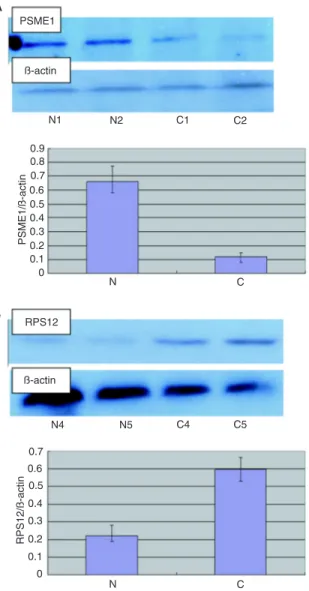 Figure  2.  RT-PCR  analysis  of  PSME1  and  RPS12.  A,  Down- Down-regulation  of  PSME1  in  chronic  atrophic  gastritis  (CAG)  (C)   tis-sue
