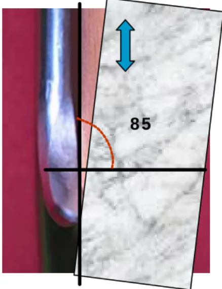 FIGURA 15 - Posição inicial  da face lateral da cureta em  relação a pedra (aprox. 75 o ) 
