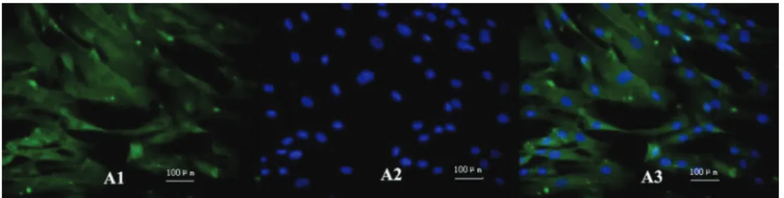 Figure 1. Identification of rat pulmonary arterial smooth muscle cells using a mouse anti-human smooth muscle a-actin monoclonal antibody