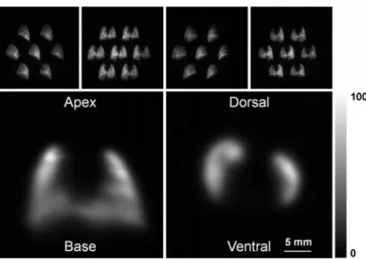 Figure 6. Bone images. Upper panels, sequence of 4 of the 16 projections obtained with the  seven-pinhole imaging device of the mouse head area, labeled with 99m Tc-MDP