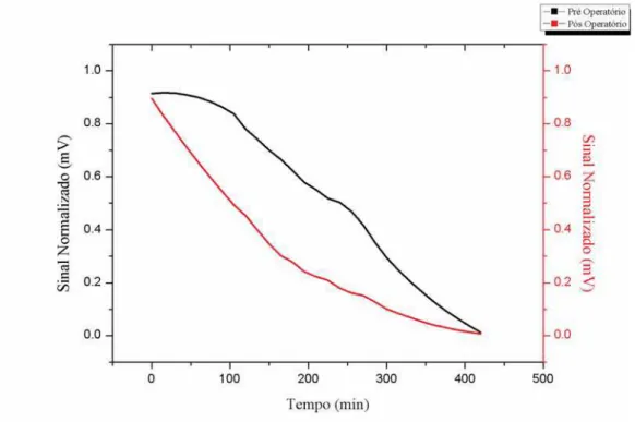 Gráfico 1 : Representação do sinal magnético normalizado em função do tempo para o ponto 1 (estômago)