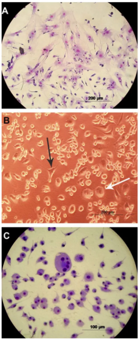 Figure 2. Morphology of colony-forming unit-granulocyte/macro- unit-granulocyte/macro-phage colonies in cultures treated with imatinib mesylate (IM).