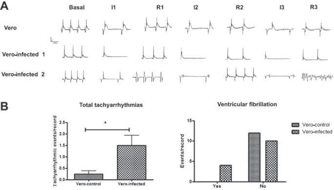 Figure 3. Panel A shows representative ECG recordings of the ischemia-reperfusion process for different perfused media