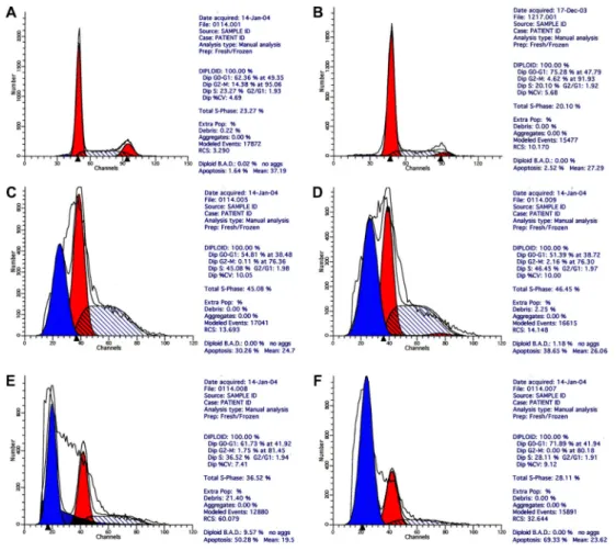 Figure 5. Flow cytometry of SMMC-7721 cells after treatment. A, Control group A (RPMI 1640 culture medium only); B, spiking group (8 g/L Fe 2 O 3 , no radiation); C, 2 g/L Fe 2 O 3 MFH group; D, 4 g/L Fe 2 O 3 MFH group; E, 6 g/L Fe 2 O 3 MFH group; F, 8 g