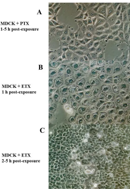 Figure  1-  Epsilon-toxin-induced  vacuolation  in  MDCK  cells.  A)  MDCK  cells  exposed  to  prototoxin  (PTX)  at  1  to  5  h  of  observation;  B)  MDCK  cells  were  incubated with 20 µg/ml of epsilon toxin (ETX) at 37°C during 1 to 2 h; C) from 3  