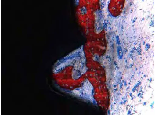 Figura 4 – Grupo controle, 21 dias (região cervical do implante). Em algumas áreas  observou-se tecido conjuntivo em contato direto com a superfície do implante  (vermelho de alizarina e azul de Stevenel, 200X)