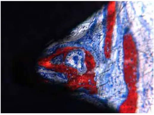 Figura 6 – Grupo controle, 21 dias (região medular). Poucas trabéculas ósseas  neoformadas são observadas no vale das roscas, sem o estabelecimento de uma  interface com o implante osseointegrável (vermelho de alizarina e azul de Stevenel,  200X)