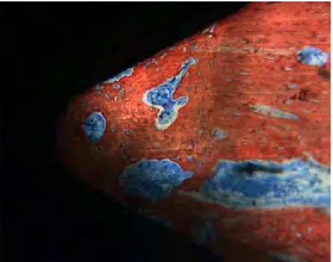 Figura 9 – Grupo tratado, 21 dias (região apical). Tecido ósseo neoformado  preenchendo a área das roscas, com inúmeras trabéculas ósseas e áreas de  contato entre o tecido ósseo e a superfície do implante (vermelho de alizarina e azul  de Stevenel, 200X)