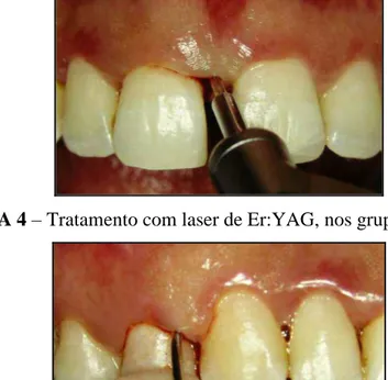 FIGURA 5 – Tratamento com RAR, nos grupos RARL e RAR. 