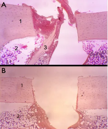 Figure 4 – Posterior cortical preserved (control) (H-E, 40x) 1: cortical bone, 2: cancellous bone.