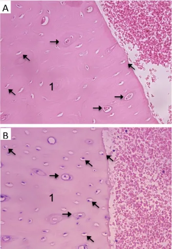 Figure 5 – A - Osteotomy at 800 rpm with irrigation (H-E, 400x) Cortical bone near the surgical defect
