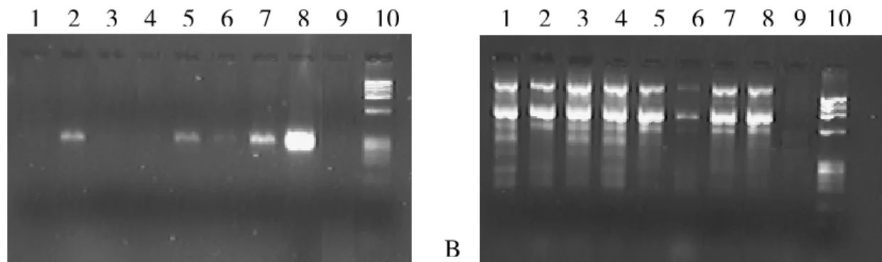 Figura 9. Gel de agarose 2% ilustrando resultados do método utilizando a enzima FastStart Taq DNA  Polymerase (Roche Diagnostics)