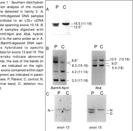 Figure 1 - Southern blot/hybrid- blot/hybrid-ization analysis of the mutant gene detected in family 2