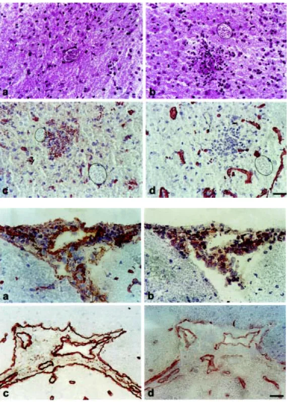 Figure 1 - Isolated T. gondii cysts (a) or parasite cysts surrounded by inflammatory infiltrates (b) w ere observed in the CNS of chronically infected mice