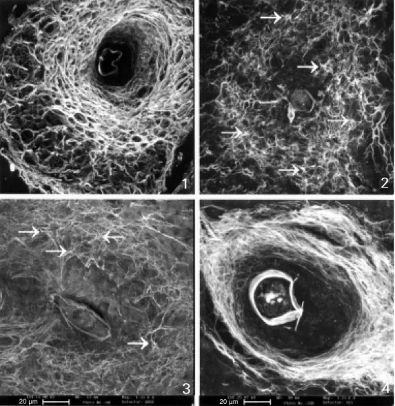 Figure 1 - (All the figures, except 7 and 8, represent black and w hite images of liver  granulo-mas originated from 3-D  recon-structions made by CSLM )