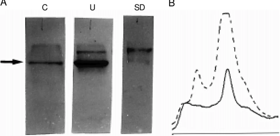 Figure 3 - Western blot reaction against laminin. These data w ere obtained as in the previous figure, blotting the membrane w ith anti-laminin antibodies (A)