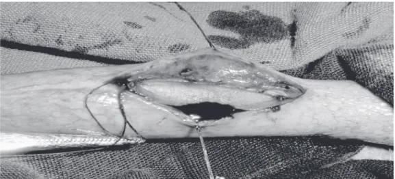 Figure 1. Bovine pericardium patch sutured to correct the urethral defect induced in a dog.