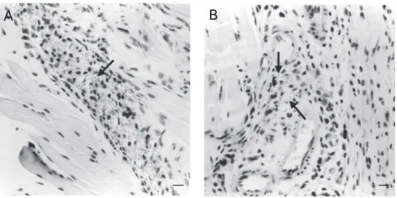 Figure 2.     Morphometric analy- analy-sis of the Leishmania (L.)  ama-zonensis subcutaneous  inocu-lation site of  de-pleted (C-) and  complement-non-depleted (C+) BALB/c mice, showing the  inflamma-tory reaction (A) and the  para-site burden of the lesi