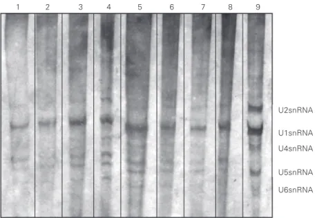 Figure 2. Western blot of serum from a patient with chagasic heart disease (lane 2 - high degree of reactivity in Figure 1, Panel I) and from a patient with non-chagasic heart disease (lane 3 - high degree of reactivity in Figure 1, Panel II) using HeLa Us