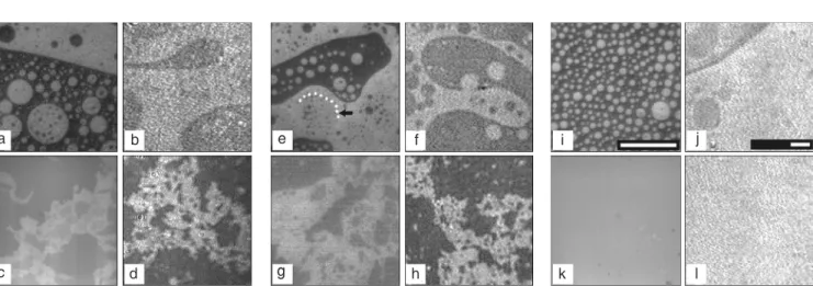 Figure 9. Surface topography of whole myelin and myelin lipid monolayers. Representative images of whole myelin extract monolayers (a, b, c, and d), lower phase extract monolayers (e, f, g, and h) and myelin lipid monolayers, except gangliosides (i, j, k, 