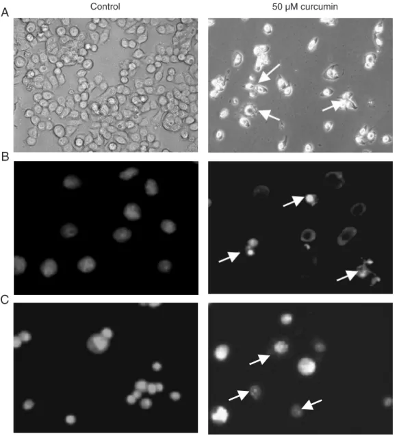 Figure 3. Morphological changes of HT-29 cells after exposure to curcumin. HT-29 cells were treated with DMSO (control) or 50 µM curcumin for 24 h