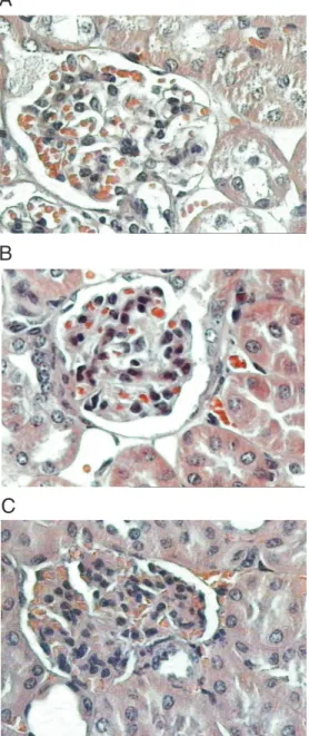 Figure 1. A, Glomerulus from a normal maximal acute  inflam-matory response (AIRmax) mouse