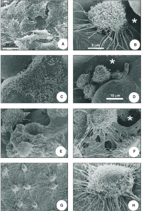 Figure 3. Scanning electron microscopy of Vero cells cultured on the polymers for 24 h