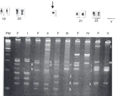 Figure 1. Top: Male infertility studies by classical cytogenetics and multiplex PCR for microdeletions of AZF gene detection