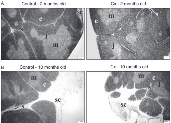 Figure 1. Photomicrographs of thymus sections derived from  2-month-old (A) and 10-2-month-old (B) controls and rats  orchidecto-mized at the age of 30 days (Cx).