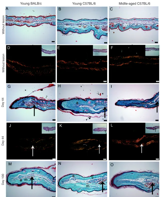 Figure 2. Histological differences in the wound healing process in ears of BALB/c and young and middle-aged C57BL/6 mice 44 and  100 days after excisional lesion with a thumb punch