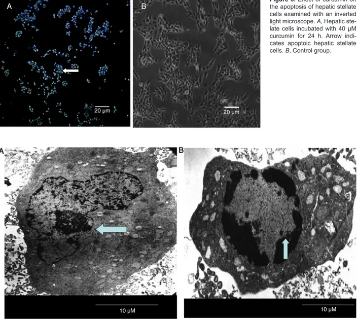 Figure 3. Effect of curcumin on  the apoptosis of hepatic stellate  cells examined with an inverted  light microscope