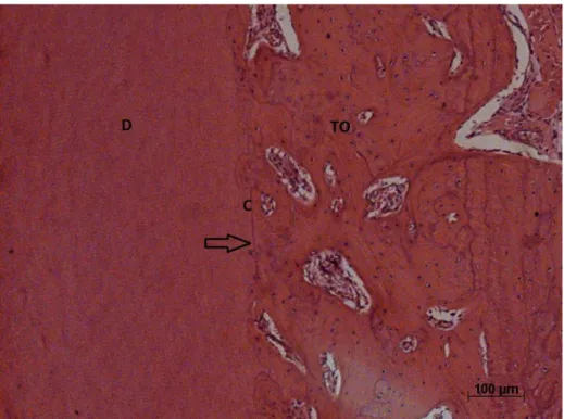 Figura  9  -  Pontos  de  anquilose  (seta).  Dentina  (D),  Cemento  (C),  Tecido  ósseo (TO)