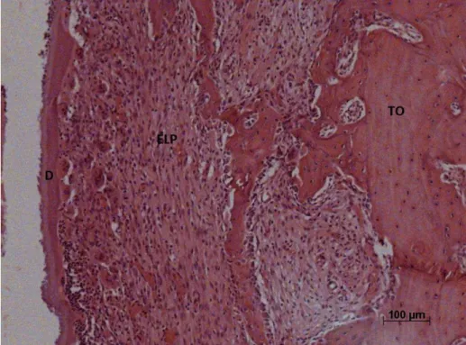 Figura 11 - Extensas áreas de reabsorção radicular ativa (seta). Dentina (D),  Tecido ósseo (TO), Espaço do ligamento periodontal (ELP)