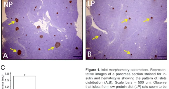 Figure 1.  Islet morphometry parameters. Represen- Represen-tative  images  of  a  pancreas  section  stained  for   in-sulin  and  hematoxylin  showing  the  pattern  of  islets  distribution  (A,B)