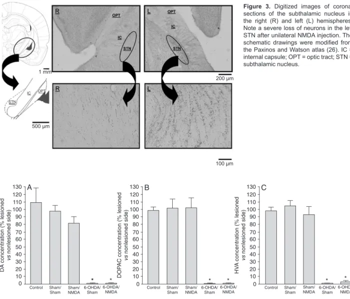 Figure  3.  Digitized  images  of  coronal  sections  of  the  subthalamic  nucleus  in  the  right  (R)  and  left  (L)  hemispheres