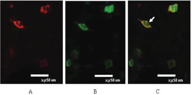 Figure 2.  Immunofluorescent co-localization test.  A , pDsRed/ATP1B1 localized in the cell membrane;  B , the pEGFP/