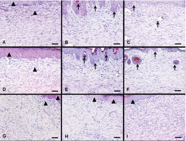 Figure  2.  Effects  of  different  physical  training  intensities  on  the  formation  of  granulation  tissue  and  the  appearance  of  neo-epidermis 14 days after wounding