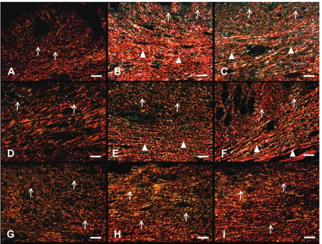 Figure 3.  Effects of different physical training intensities on the organization and distribution of collagen fibers in the granu - -lation tissue 14 days after wounding